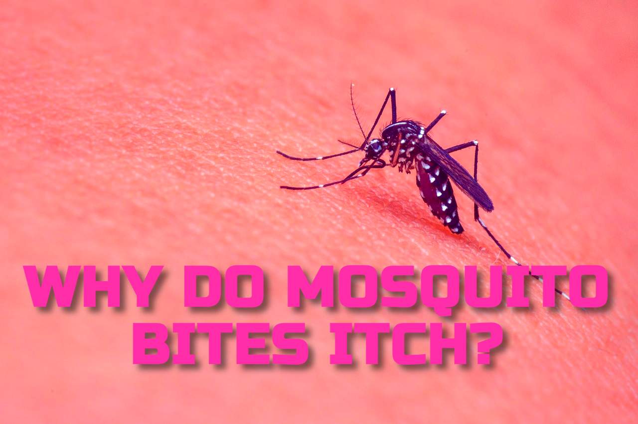 WHY DO MOSQUITO BITES ITCH